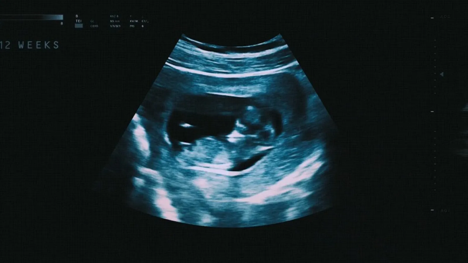 Children's Hospital Colorado - Born Twice Video Thumbnail