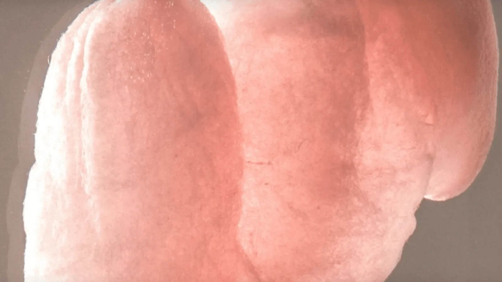 Chronology Video Thumbnail